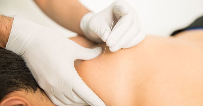 Intramuscular Stimulation (IMS)