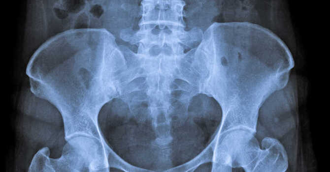 Pelvic Floor Dysfunction